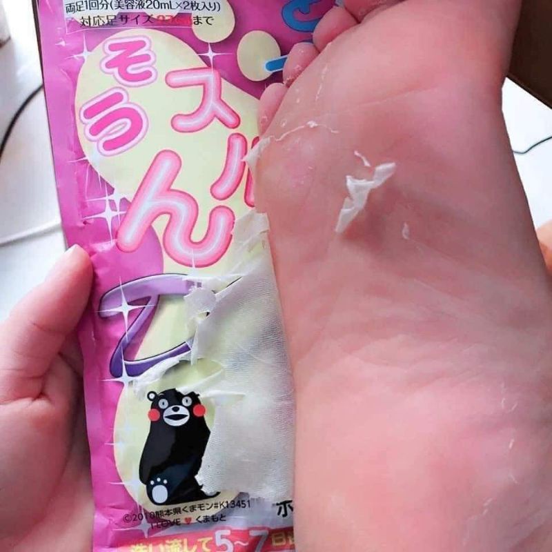 Túi Ủ Chân tẩy tế bào da chết Mino Baby Foot DX Nhật Bản Chính Hãng
