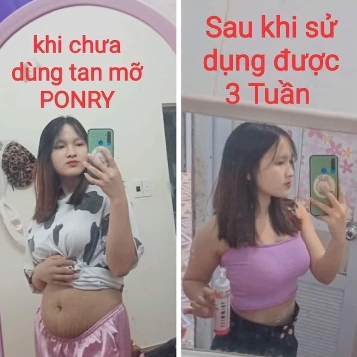 COMBO TAN MỠ PONRY