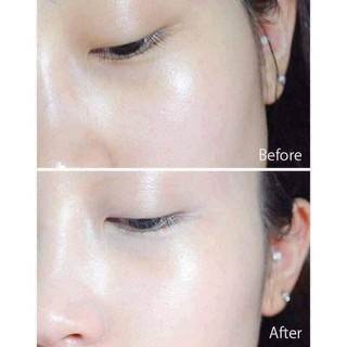 SERUM TINH CHẤT BALANCE