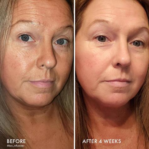 Wander Beauty kem dưỡng retinol 1% Do Not Disturb cấp nước giảm nhăn, mụn, chống lão hoá,sáng da, làm min da, săn chắc b