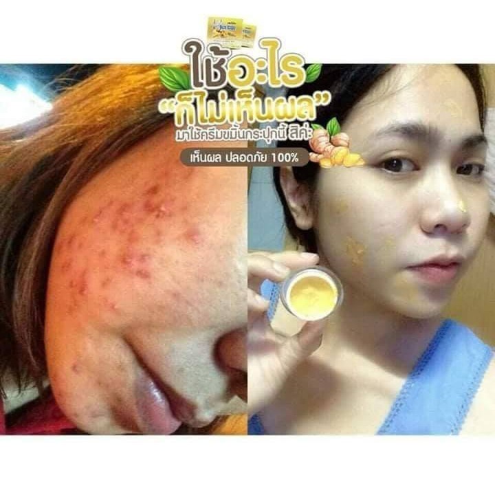 Combo kem + serum Nghệ Turmeric Herbal Thái LanThâm Mụn/Trắng Da