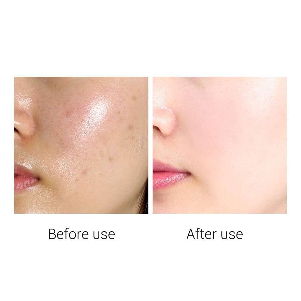 Mặt nạ Breylee chứa Collagen Vitamin C Retinol chuyên dụng làm trắng da hỗ trợ giảm mụn 25ml