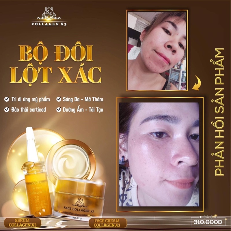 [Chính hãng] Combo Lột Xác Face + Serum Collagen X3 Mỹ Phẩm Đông Anh | BigBuy360 - bigbuy360.vn