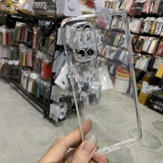 Ốp lưng OnePlus 8T dẻo trong cty