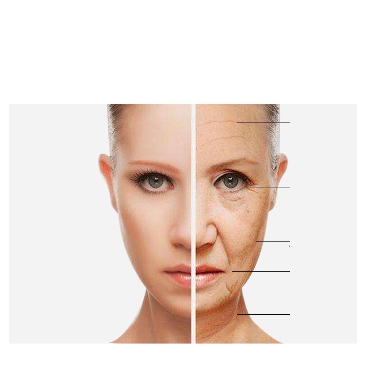 Máy nâng cơ trẻ hóa da xóa nhăn tạo mặt Vline HIFU Vmax