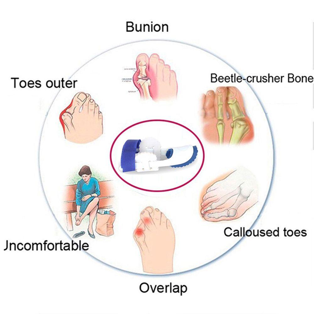 Dụng Cụ Chỉnh Hình Ngón Chân Cái Cong Chăm Sóc Chuyên Nghiệp Giảm Đau