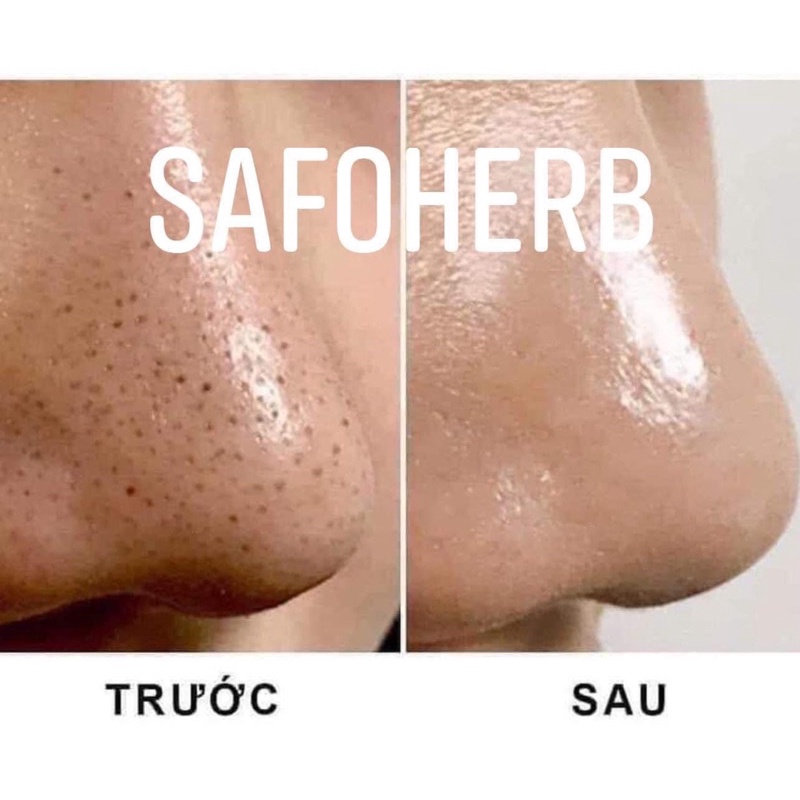 Serum Safoherb 10ml | BigBuy360 - bigbuy360.vn