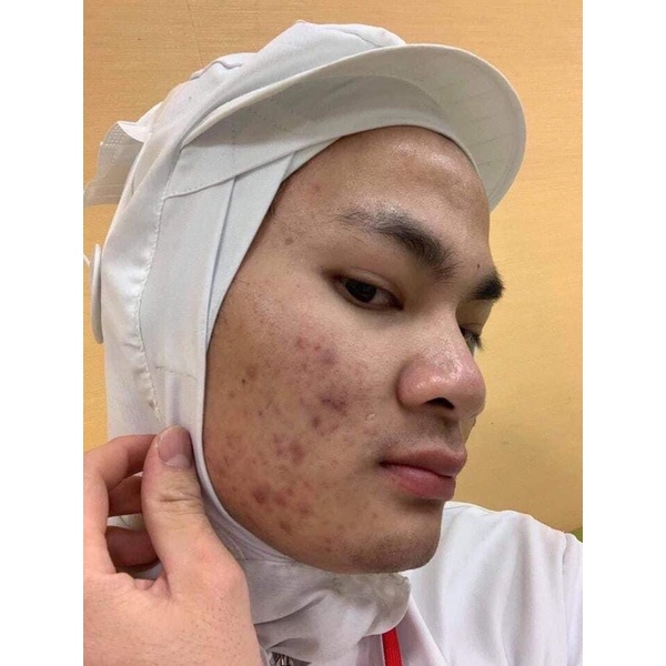 SERUM KHỔ QUA( mướp đắng)tặng kèm que nặn mụn | BigBuy360 - bigbuy360.vn