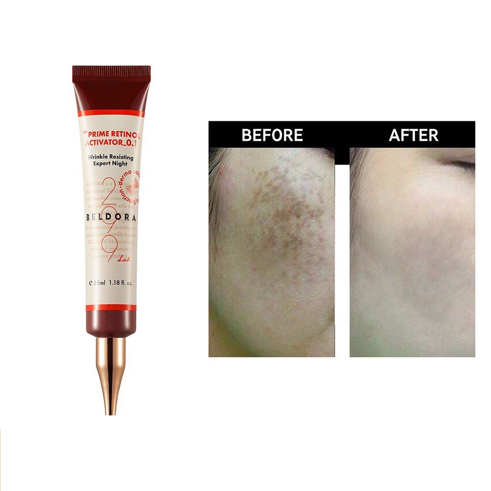 Kem Dưỡng Retinol 0.3 Giảm Nếp Nhăn, Căng Bóng Da Beldora 299 Prime Retinol Activator 0.3 35ml - Miss Xinh