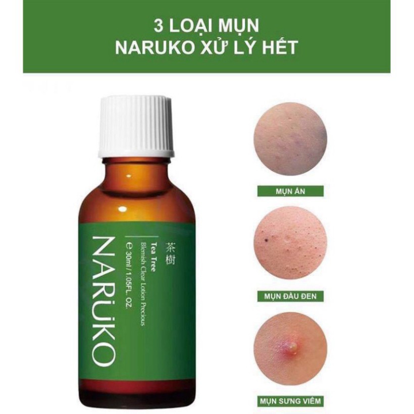 NARUKO - Lotion Tràm Trà Đậm Đặc Giảm Mụn Mảng, Mụn Đầu Đen 30ml – Tea Tree Blemish Clear Lotion Precious 30ml H30