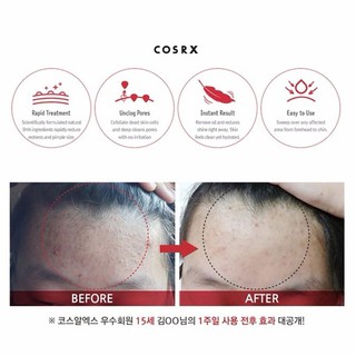 Pad tẩy da chết Cosrx 70 miếng