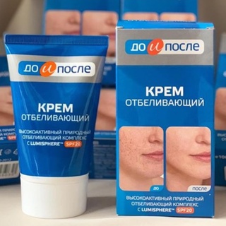 Kem Nám Và Tàn Nhang KpeM Nga