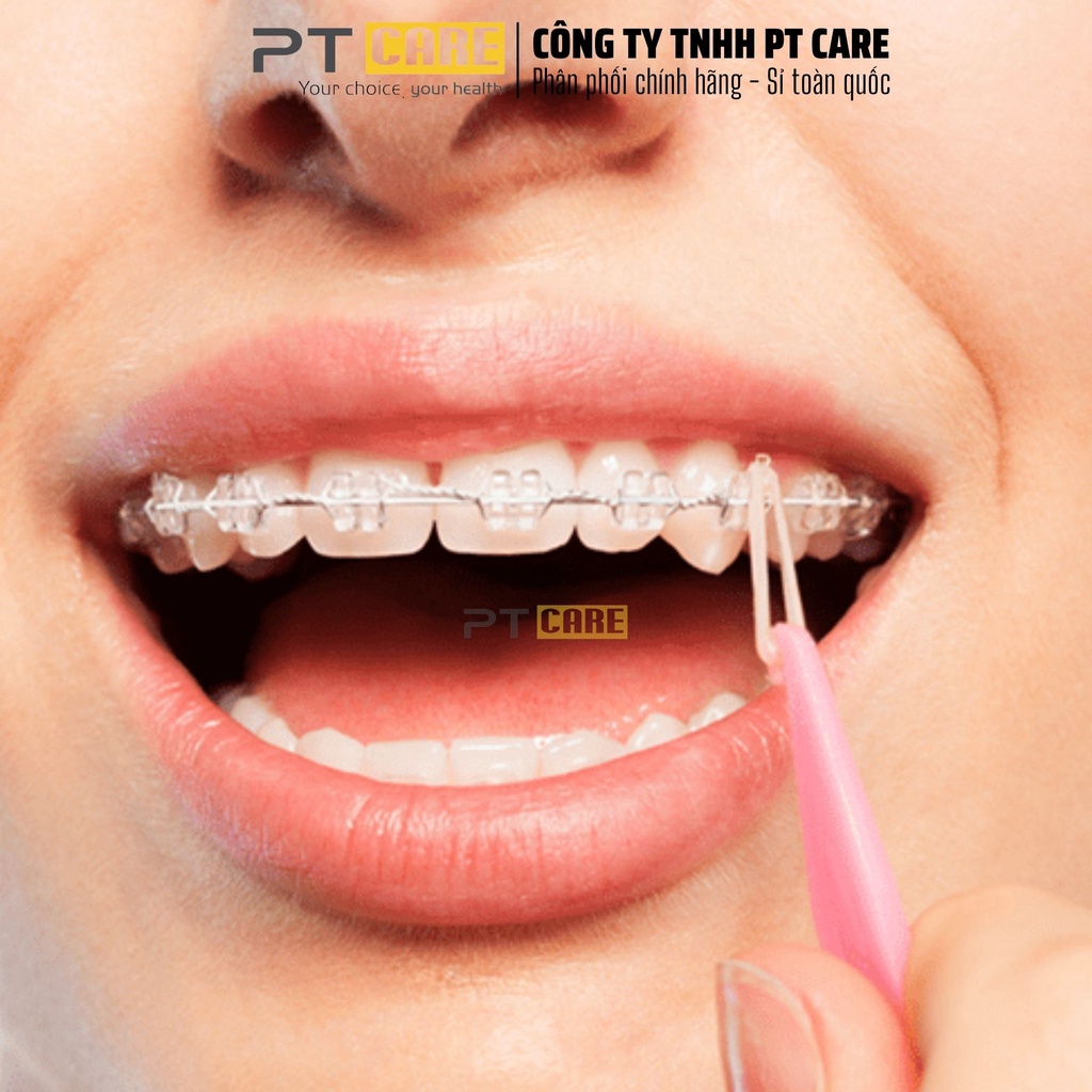 PT CARE | 01 Cái Kéo Thun Cây Đeo Chun Liên Hàm Chỉnh Nha Niềng Năng