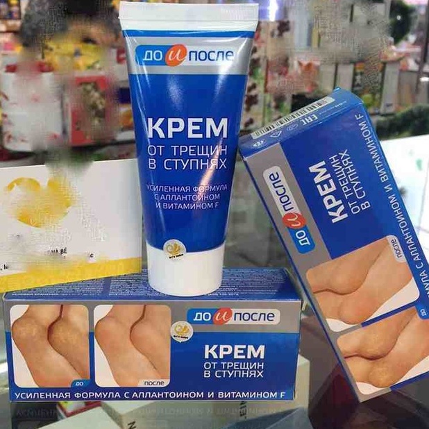 Kem giảm nứt gót chân Kpem Apteka Nga 50ml giữ ẩm cho da, làm mềm da chân