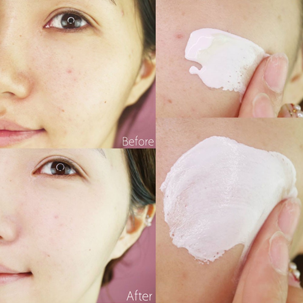 Kem dưỡng trắng Shiseido Senka White Beauty Cream