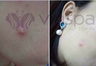 Mặt nạ tím Violet Viospa