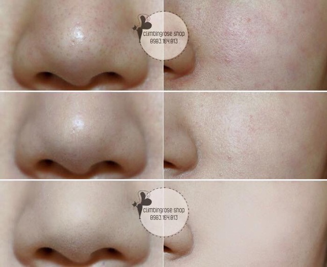 Phấn Shiseido Baby Pressed