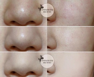[NHẬP KHẨU] Phấn Shiseido Baby Pressed