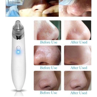 Máy hút mụn mini sạc pin cao cấp