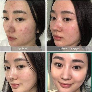 TONER AHA-BHA-PHA 30DAYS - SOME BY MI