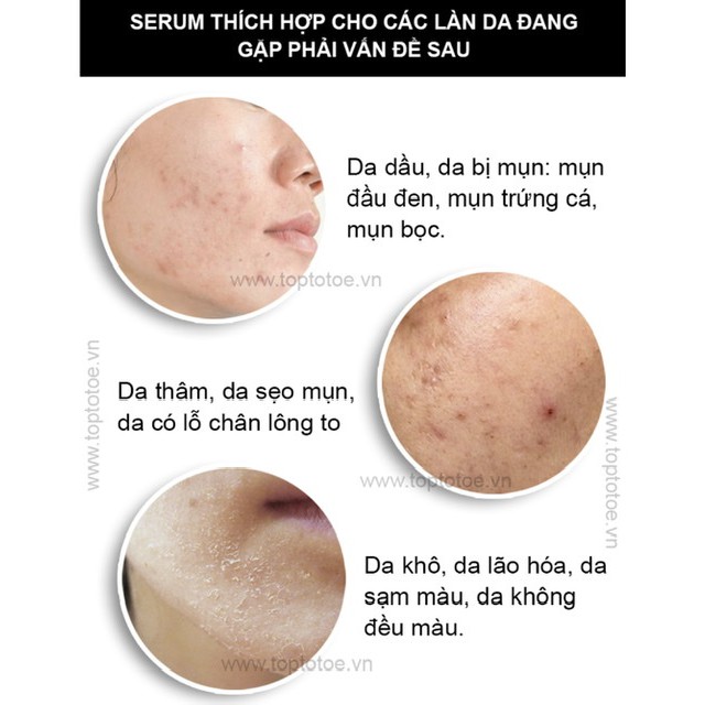 (bill hãng) Tinh chất Niacinamide 10% + Zin C 1%