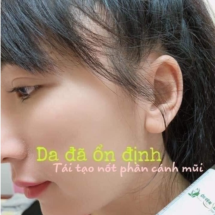 Mụn Nám Thảo Dược QuyênLara Đánh Bay Mụn,Nám,Tàn Nhang ,Tái Tạo Lại Làn Da Mới An Toàn,Hiệu Quả Sau 1 Liệu Trình 150Ml