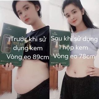 Kem tan mỡ Goslim