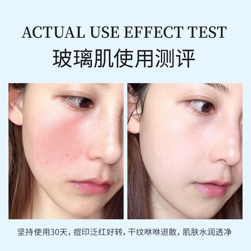 Mặt nạ HLLSEES dưỡng ẩm tái tạo làm mịn da