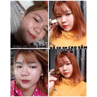 [Beman123] CAO MỤN SÂM ĐỎ FULLBOX 15GR