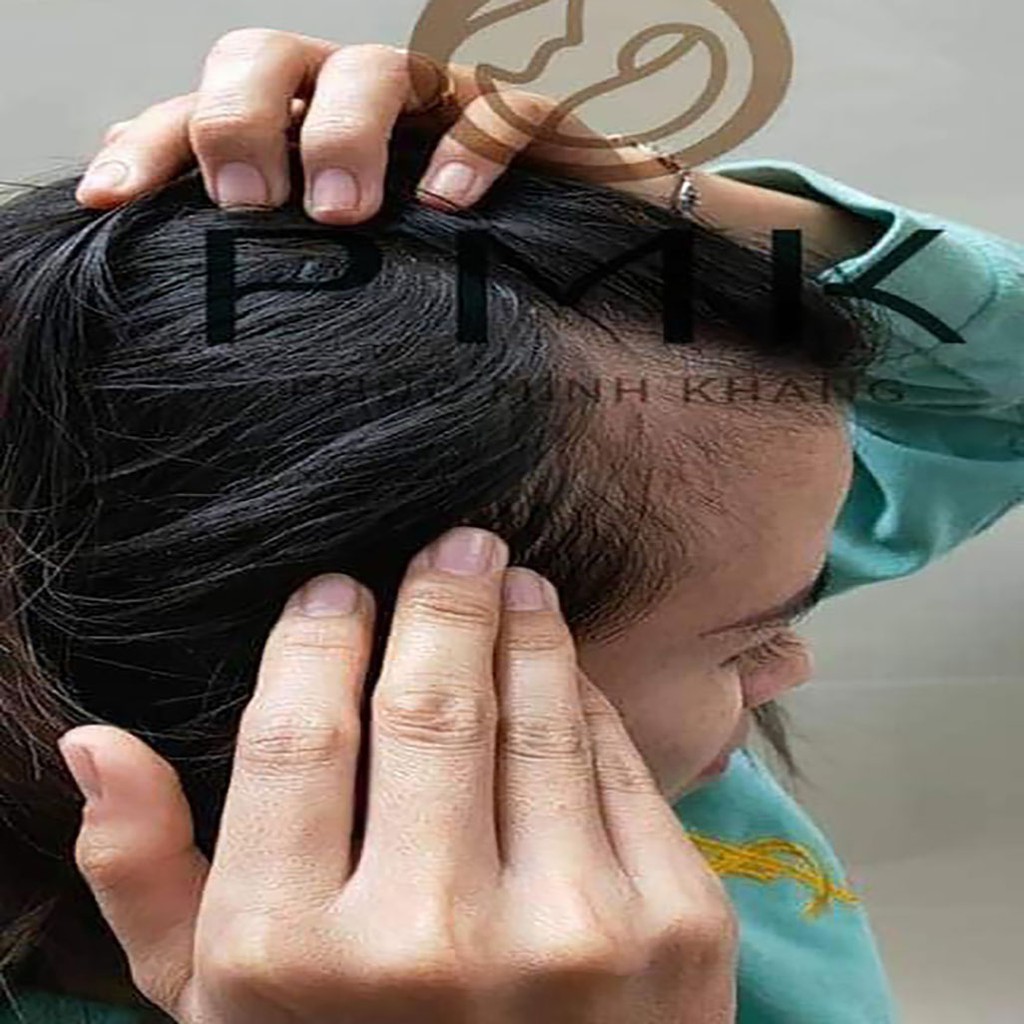Tinh chất mọc tóc Minh Khang - Hiệu quả sau 7-10 ngày sử dụng - Tặng quà ngẫu nhiên hấp dẫn