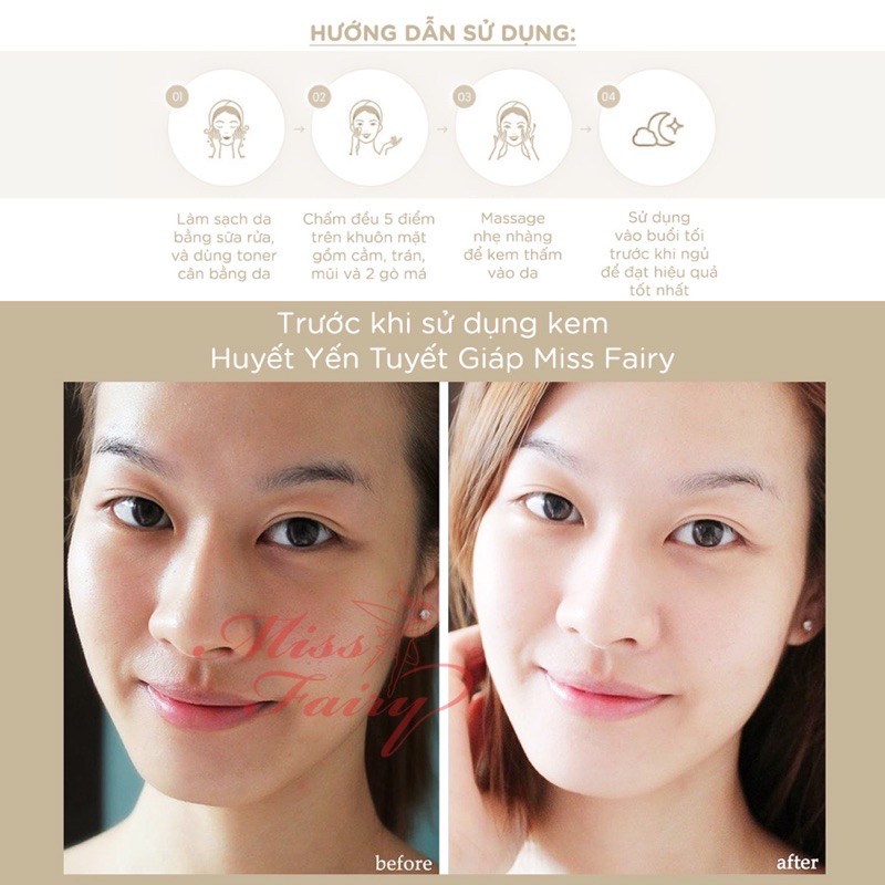 KEM MISSFAIRY DƯỠNG TRẮNG DA HUYẾT YẾN & TUYẾT GIÁP - BIRD'S