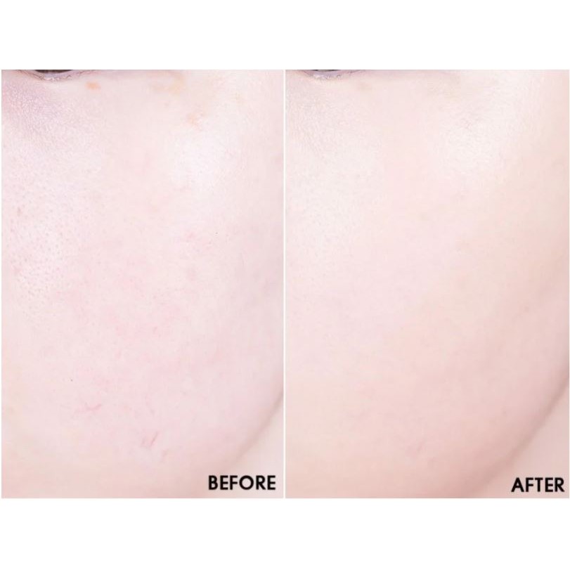 Set 3 Sản Phẩm Trang Điểm Che Phủ Cao Cho Lớp Nền Hoàn Hảo A.Black All Day Perfect Cover Cushion SPF47/PA++ | BigBuy360 - bigbuy360.vn