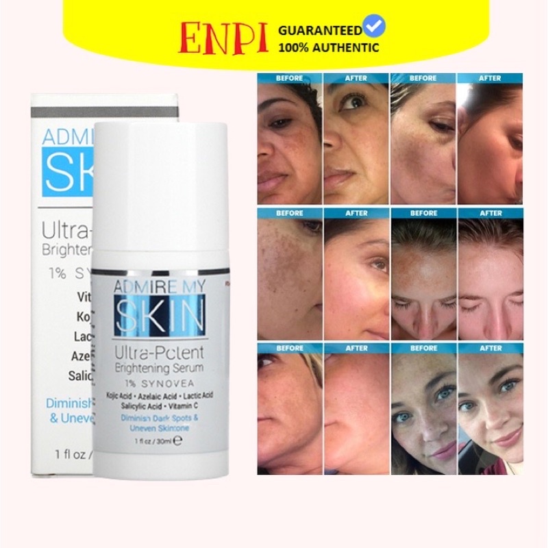 tinh chất mở nám tàn nhang trắng da serum admire my skin ultra potent brightening serum