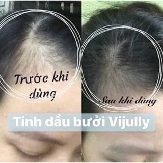 XỊT BƯỞI MỌC TÓC 𝑽𝑰𝑱𝑼𝑳𝑳𝒀  chai 100ml