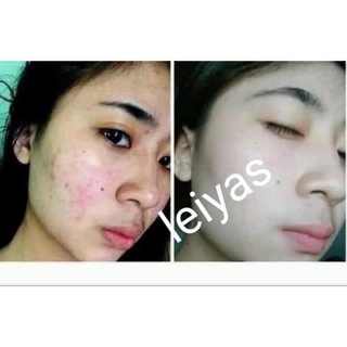 kem  dưỡng  leiyas 10gr
