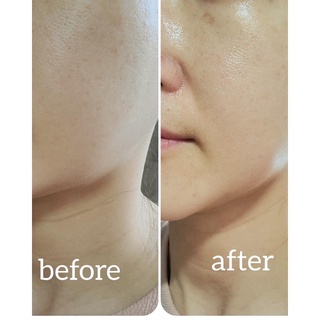 Tinh chất  Dr.Pepti Peptide Volume Master Essence  dưỡng trắng da