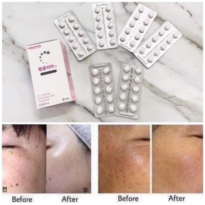 Viên uống mờ hủy nám M clear