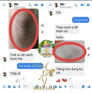 BIHO LADI [COMBO 2 HỘP] SIÊU DƯỠNG THÂM 5S (Biho Lady loại bỏ thâm hôi nách bẹn mông bikini )