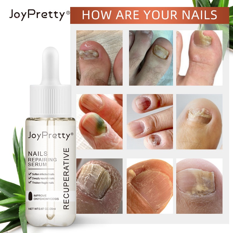 Serum Kích Thích Mọc Móng Nhanh Chóng Và Hiệu Quả