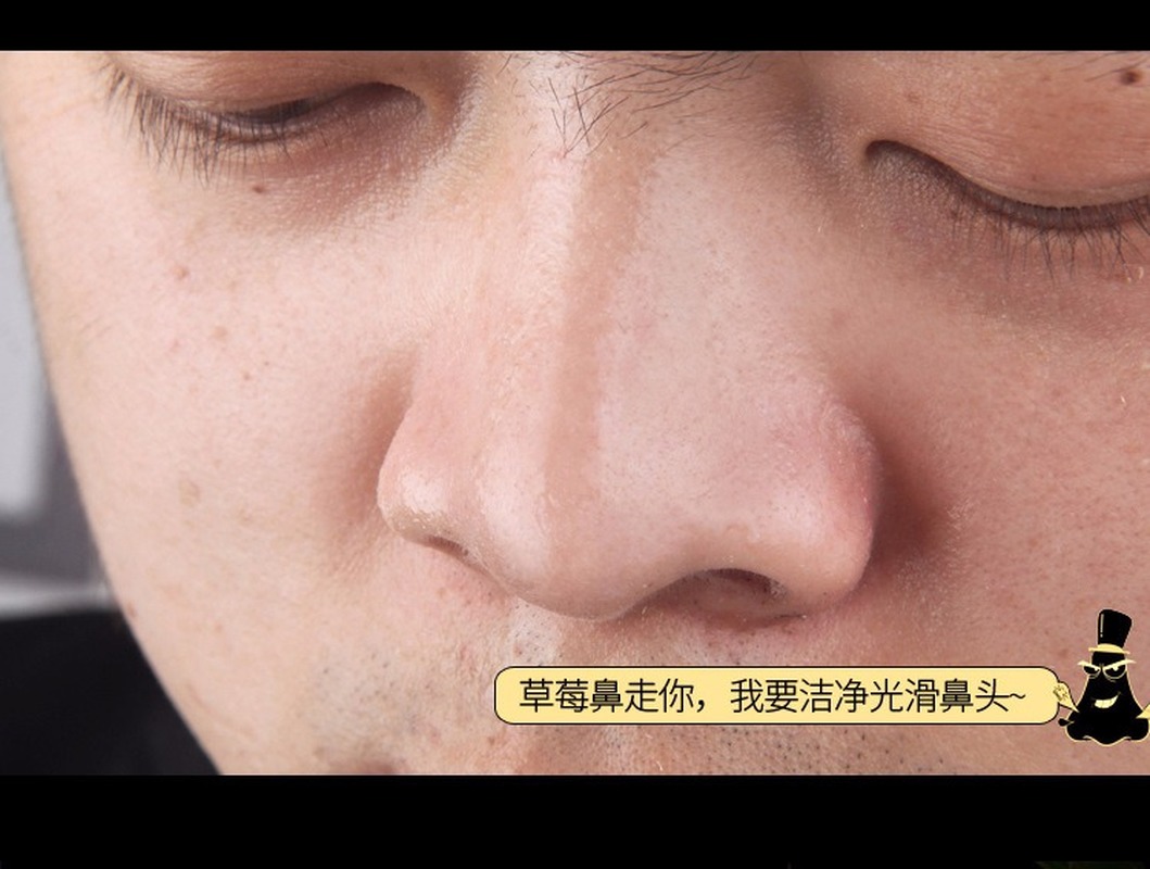 Mặt nạ bùn khoáng lột mụn đầu đen cho mũi Mimi N's Le's tiện dụng | BigBuy360 - bigbuy360.vn