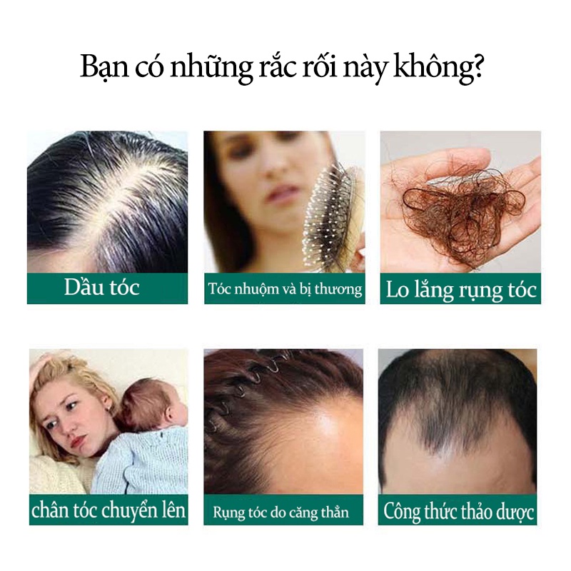 Tinh dầu mọc tóc nhanh 30ml xịt mọc tóc tinh chất mọc dày tóc chống rụng tóc nuôi dưỡng mái tóc Hiệu quả nhanh
