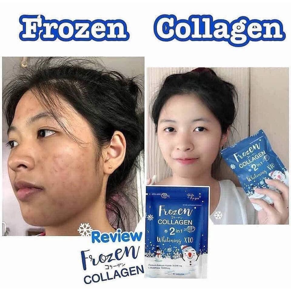 Nội Địa Thái | 60 Viên Uống Trắng Da Frozen Thái Lan