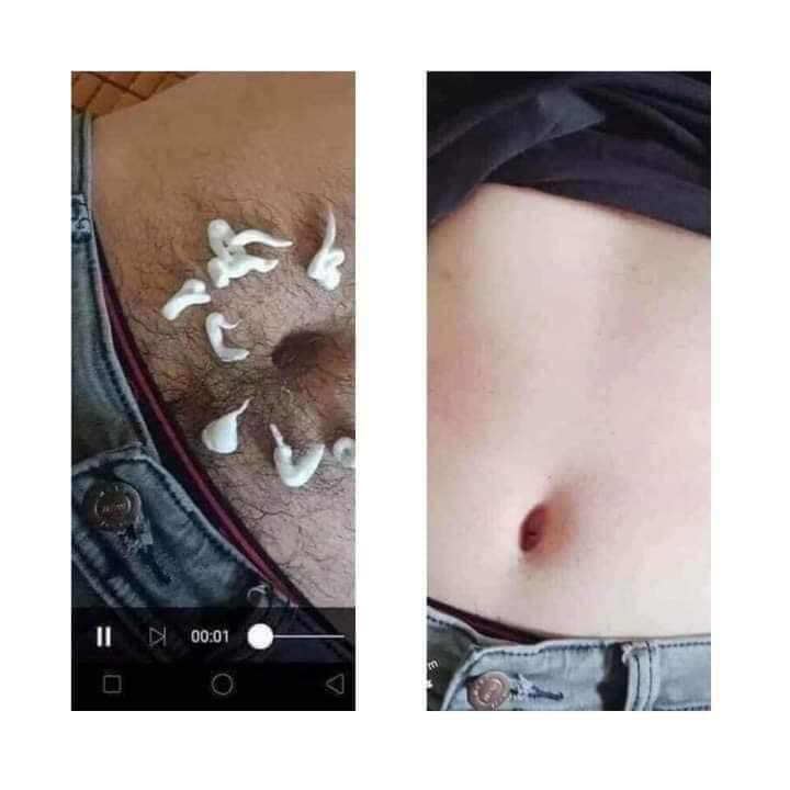 COMBO KEM TẨY LÔNG CHANH GẤC DIAMOND SKIN CHÍNH HÃNG (TRIỆT LÔNG CHANH GẤC DIAMOND SKIN) | BigBuy360 - bigbuy360.vn