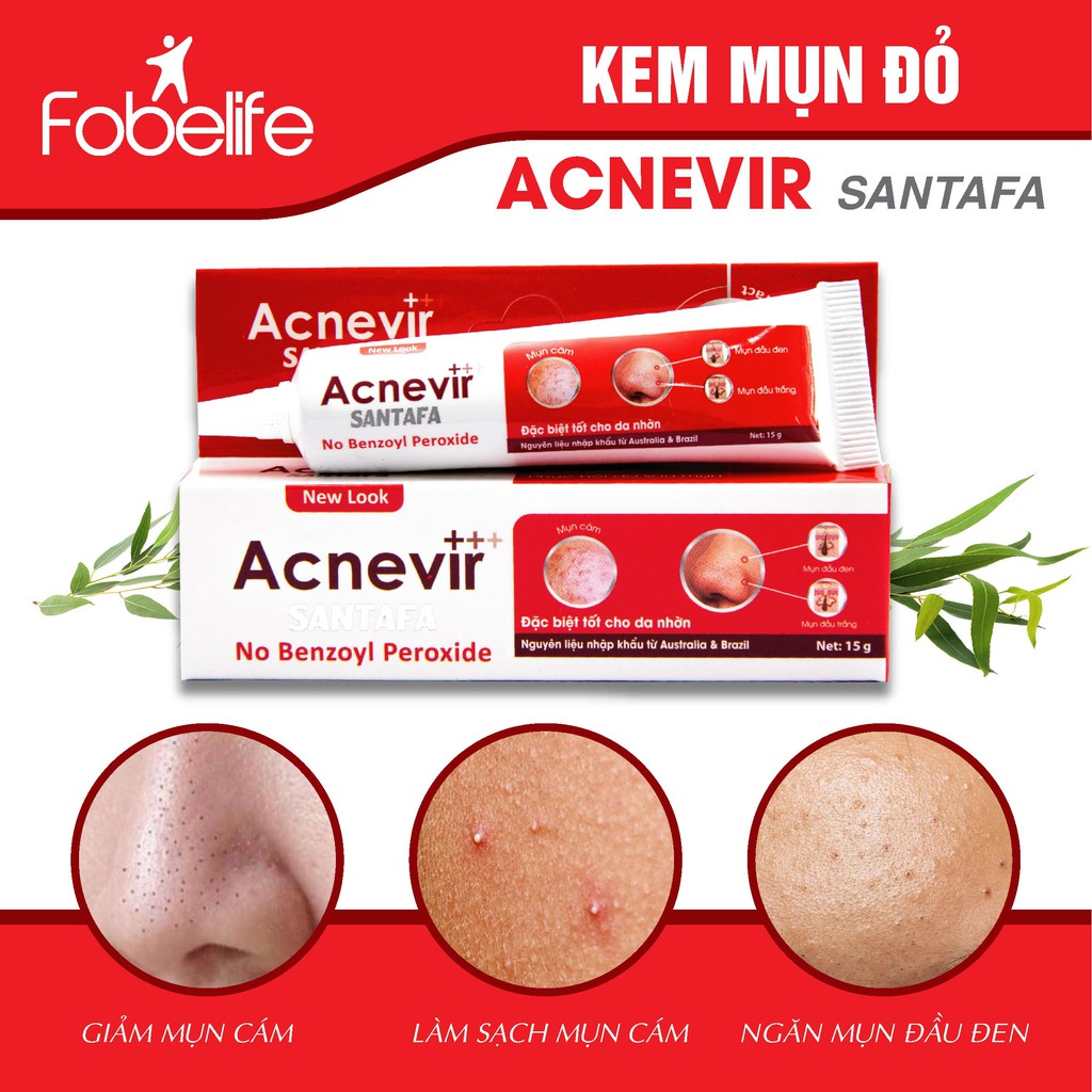 Kem Giảm Mụn Đầu Đen Mụn Cám Hiệu Quả Acnevir Santafa Fobe- Tuýp 15gr