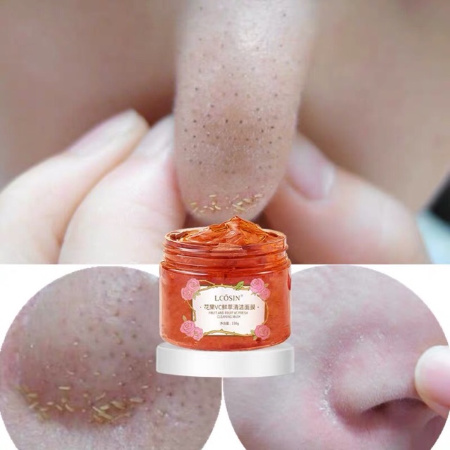[Trả order] Gel đẩy mụn hoa hồng