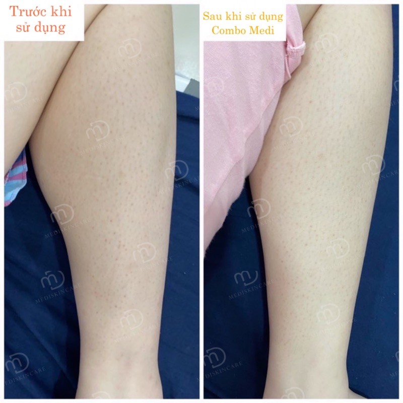 Body Mask Mediskincare | BigBuy360 - bigbuy360.vn