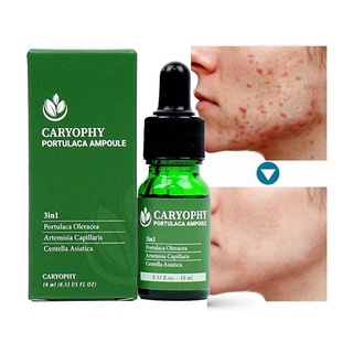 Tinh Chất Caryophy Portulaca Ampoule