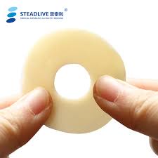 Vòng chống loét (1 vòng) hậu môn nhân tạo