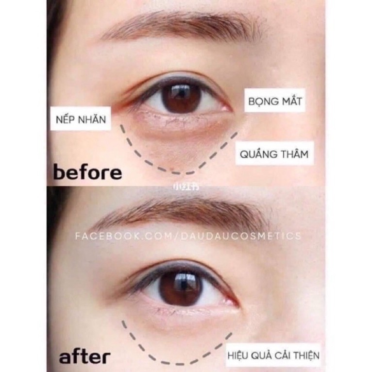 (Mẫu mới nhất) Kem dưỡng da mắt Kracie Hadabisei Wrinkle Care Facial Cream Nhật Bản giảm nhăn, giảm thâm [Nội Địa Nhật]