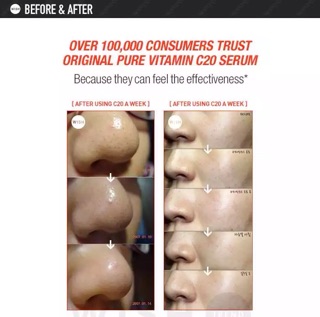 Tinh chất vitamin C 21.5